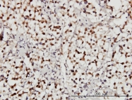 H00009736-M01 - USP34