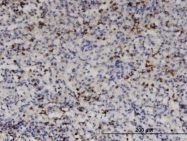 H00009759-M03 - HDAC4
