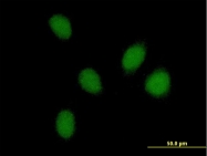 H00009767-B01P - PHF16 / JADE3