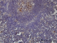 H00009768-M01 - PAF