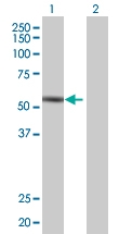 H00009807-B01 - InsP6 kinase 1 / IP6K1