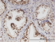 H00009818-M01 - NUPL1