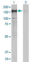 H00009918-M01 - NCAPD2