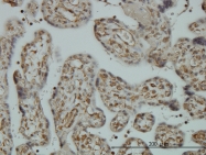 H00009918-M01 - NCAPD2