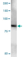 H00009933-D01 - KIAA0020
