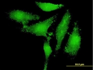 H00009943-B01 - OXSR1 / OSR1