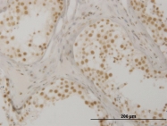 H00009943-M02 - OXSR1 / OSR1
