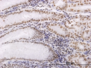 H00009943-M03 - OXSR1 / OSR1