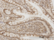 H00009943-M04 - OXSR1 / OSR1