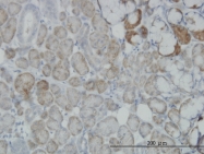 H00009943-M16 - OXSR1 / OSR1