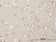 H00009960-B01 - USP3