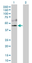 H00010000-D01P - AKT3 / PKB gamma