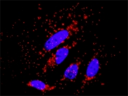H00010000-M08 - AKT3 / PKB gamma