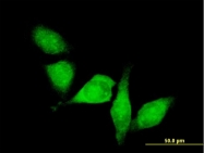 H00010013-B01P - HDAC6