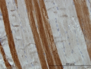 H00010043-M01 - TOM1