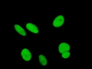 H00010055-B01P - SAE1 / AOS1