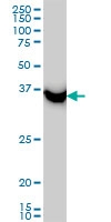 H00010055-M01 - SAE1 / AOS1