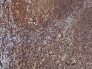H00010056-M01 - FARSB