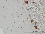 H00010056-M01 - FARSB