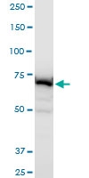 H00010058-A01 - ABCB6