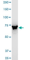 H00010058-A01 - ABCB6