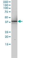 H00010073-M01 - Snurportin-1 (SNUPN)