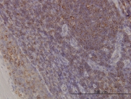 H00010096-M02 - ACTR3