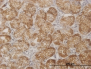 H00010110-M13 - SGK2