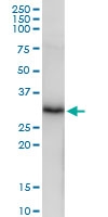 H00010136-D01 - Elastase-3A