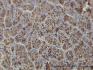 H00010136-M02 - Elastase-3A
