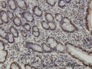 H00010155-M01 - TIF1-beta / TRIM28