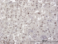 H00010155-M02 - TIF1-beta / TRIM28