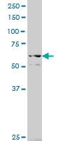 H00010188-A01 - TNK2 / ACK1