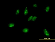 H00010200-B01 - MPHOSPH6