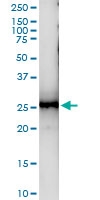 H00010219-D01 - KLRG1