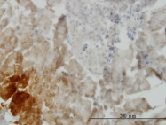 H00010220-M01 - BMP11 / GDF11