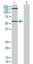 H00010223-B01 - Cell surface A33 antigen / GPA33