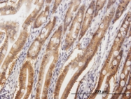 H00010223-B01 - Cell surface A33 antigen / GPA33