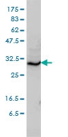 H00010228-M01 - Syntaxin 6 / STX6