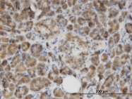 H00010249-M07 - GLYAT / ACGNAT