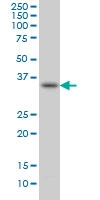 H00010252-M01 - Sprouty homolog 1 / SPRY1
