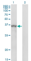 H00010252-M01 - Sprouty homolog 1 / SPRY1