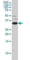 H00010253-M01 - Sprouty homolog 2 / SPRY2