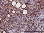 H00010253-M01 - Sprouty homolog 2 / SPRY2