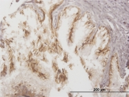 H00010257-M03 - ABCC4 / MRP4