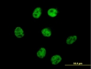 H00010270-B01 - AKAP8
