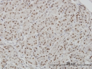 H00010270-M01 - AKAP8
