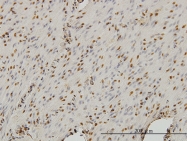 H00010274-M01 - STAG1 / Stromal antigen 1