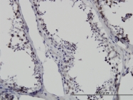 H00010285-M01 - SMNDC1