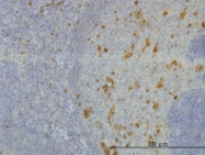 H00010327-M01 - AKR1A1 / ALDR1